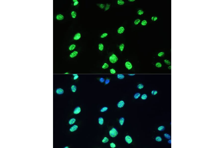Immunofluorescence - Anti-UAP56 Antibody (A12241) - Antibodies.com