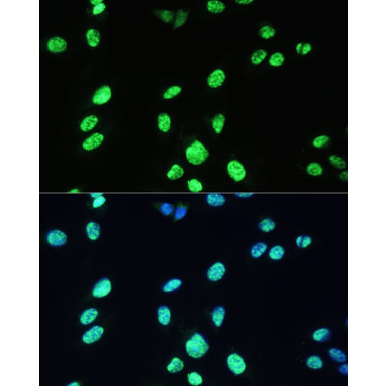 Immunofluorescence - Anti-UAP56 Antibody (A12241) - Antibodies.com