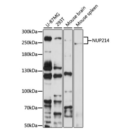 Western Blot - Anti-NUP214 Antibody (A12242) - Antibodies.com