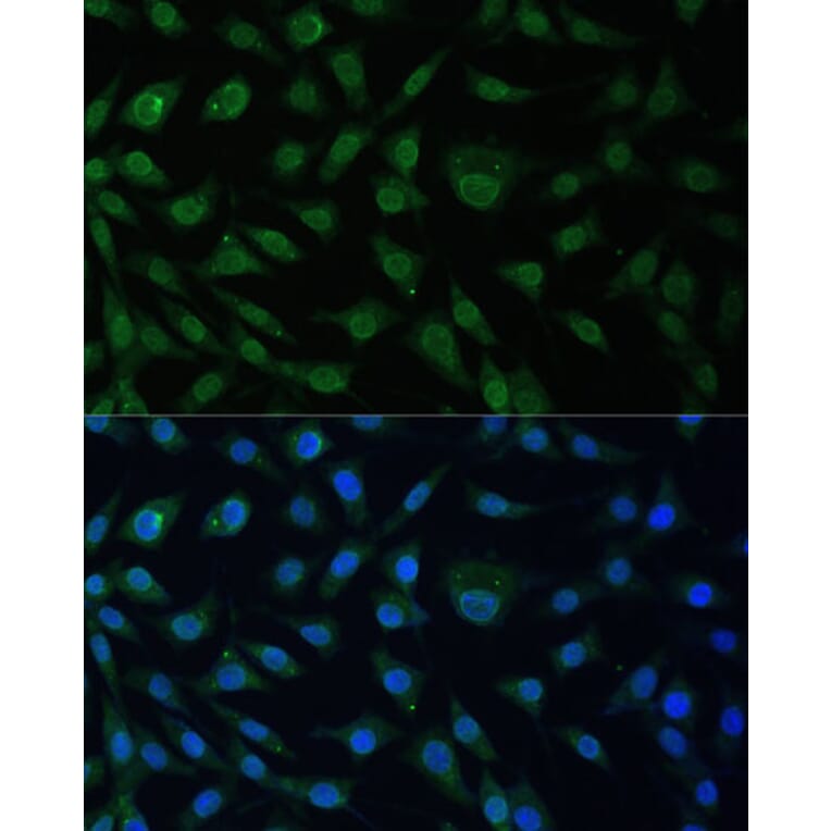 Immunofluorescence - Anti-NUP214 Antibody (A12242) - Antibodies.com