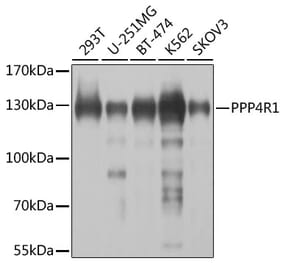 Western Blot - Anti-PPP4R1 Antibody (A12243) - Antibodies.com