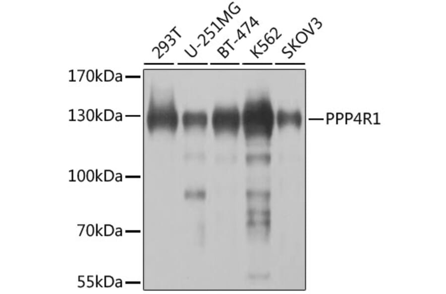 Western Blot - Anti-PPP4R1 Antibody (A12243) - Antibodies.com