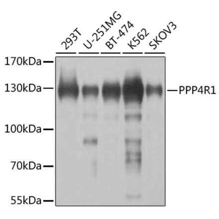 Western Blot - Anti-PPP4R1 Antibody (A12243) - Antibodies.com