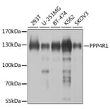 Western Blot - Anti-PPP4R1 Antibody (A12243) - Antibodies.com