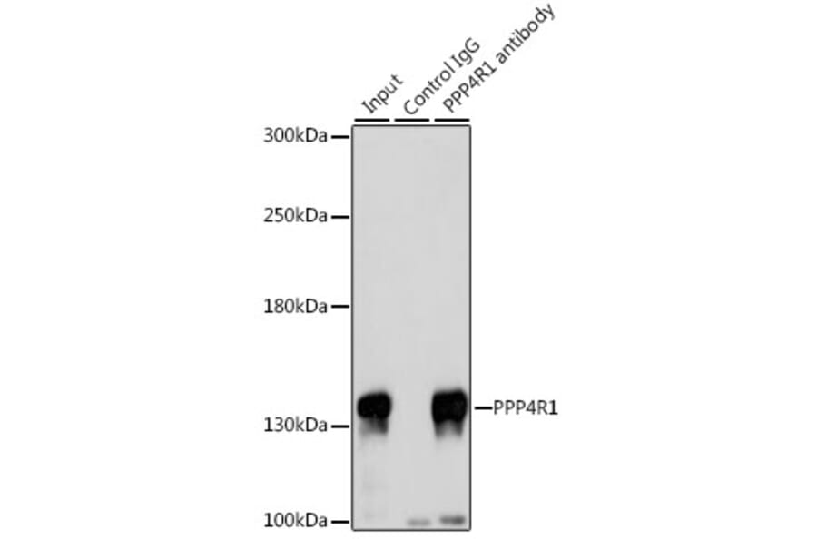 Western Blot - Anti-PPP4R1 Antibody (A12243) - Antibodies.com