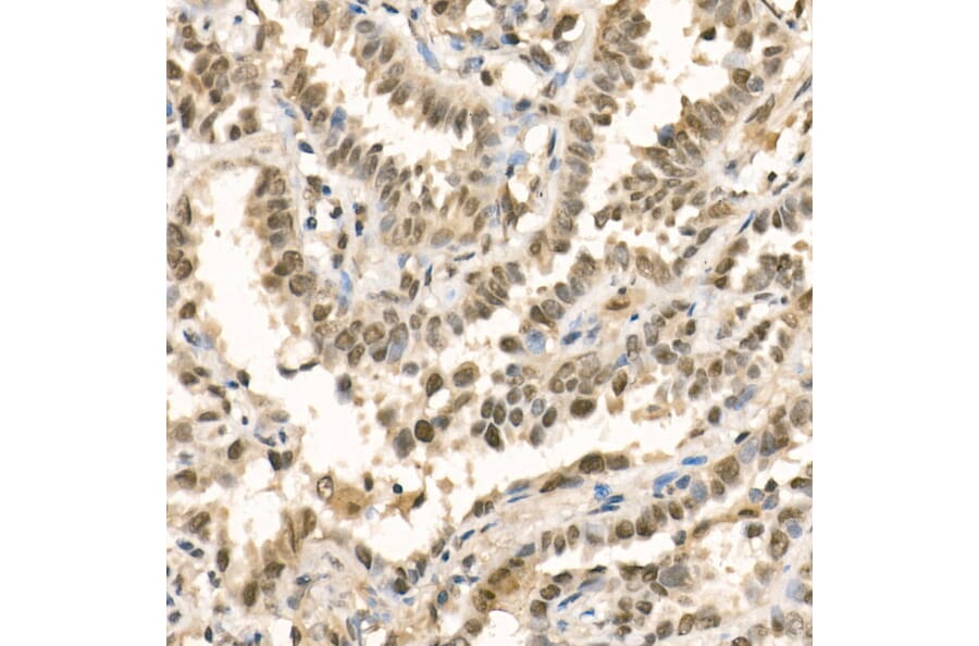 Immunohistochemistry - Anti-METTL3 Antibody (A12244) - Antibodies.com