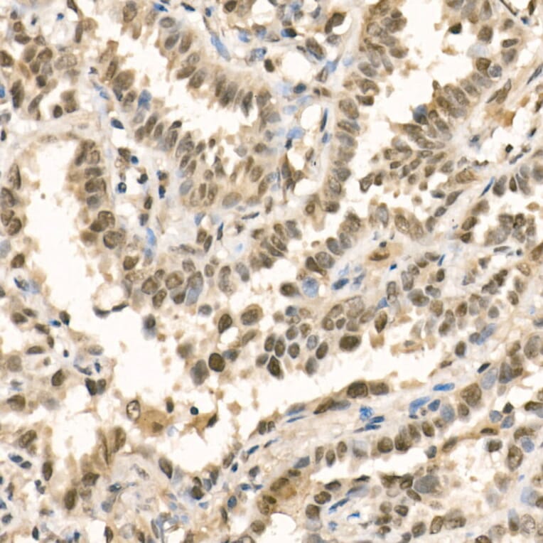 Immunohistochemistry - Anti-METTL3 Antibody (A12244) - Antibodies.com