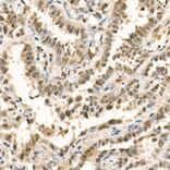 Immunohistochemistry - Anti-METTL3 Antibody (A12244) - Antibodies.com