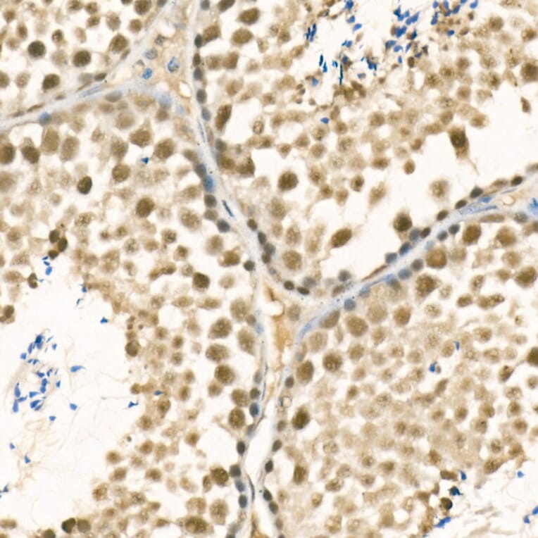 Immunohistochemistry - Anti-METTL3 Antibody (A12244) - Antibodies.com