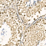 Immunohistochemistry - Anti-METTL3 Antibody (A12244) - Antibodies.com