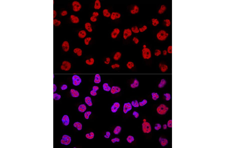 Immunofluorescence - Anti-METTL3 Antibody (A12244) - Antibodies.com