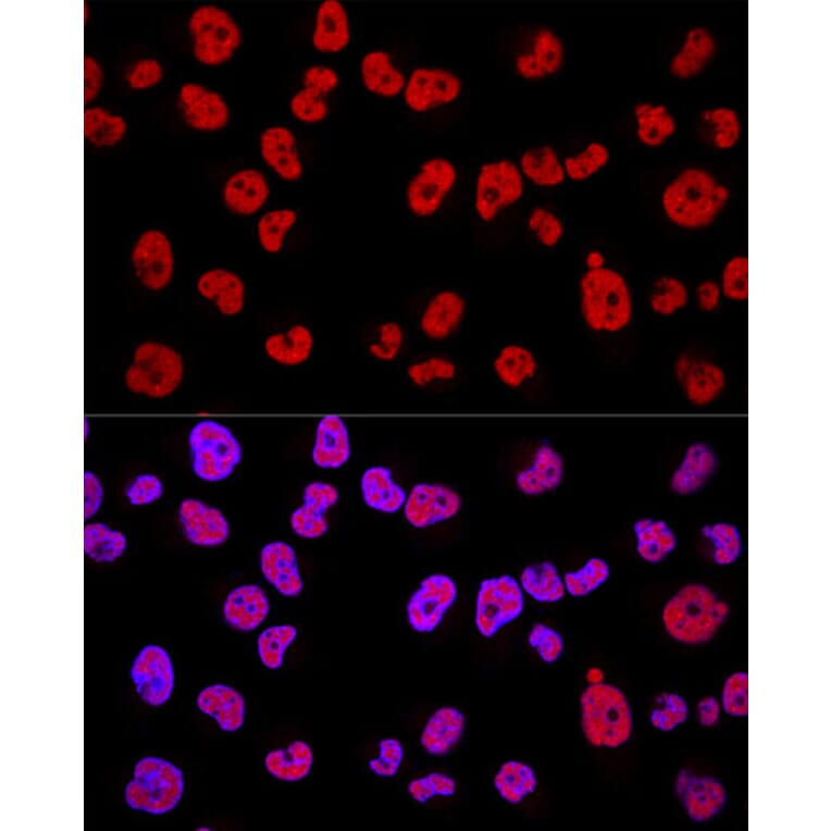 Immunofluorescence - Anti-METTL3 Antibody (A12244) - Antibodies.com