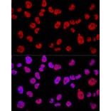Immunofluorescence - Anti-METTL3 Antibody (A12244) - Antibodies.com