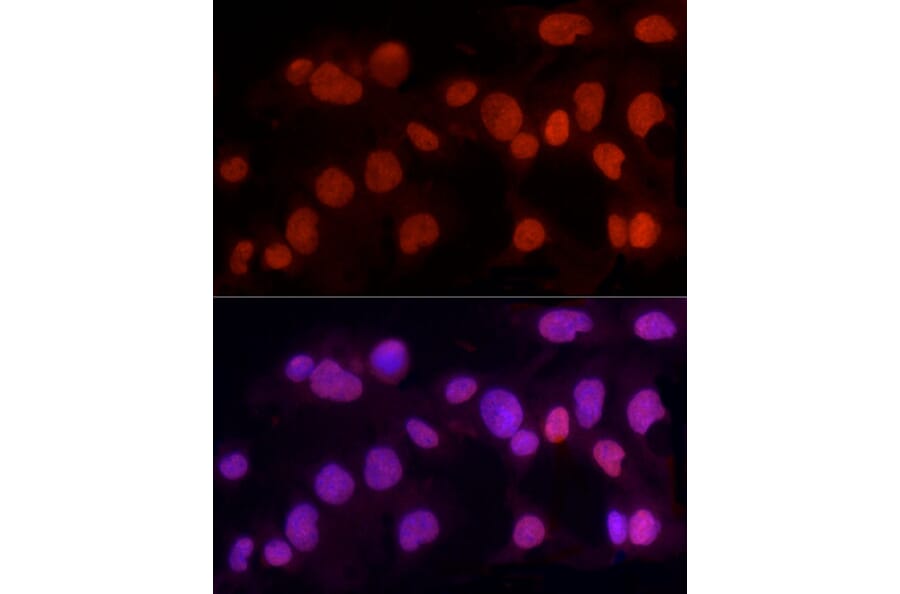Immunofluorescence - Anti-METTL3 Antibody (A12244) - Antibodies.com