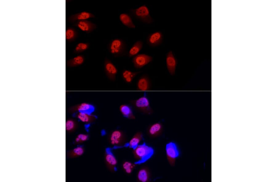 Immunofluorescence - Anti-METTL3 Antibody (A12244) - Antibodies.com