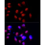 Immunofluorescence - Anti-METTL3 Antibody (A12244) - Antibodies.com