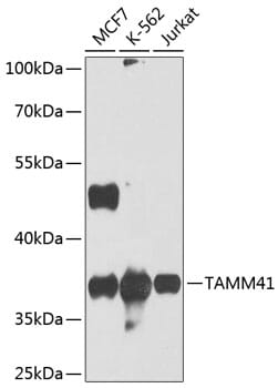 Western blot analysis of extracts of various cell lines, using Anti-TAMM41 Antibody (A8374) at 1:1,000 dilution.
Secondary antibody: Goat Anti-Rabbit IgG (H+L) (HRP) (AS014) at 1:10,000 dilution.
Lysates / proteins: 25µg per lane.
Blocking buffer: 3% non-fat dry milk in TBST.
Detection: ECL Basic Kit (RM00020).
Exposure time: 10s.