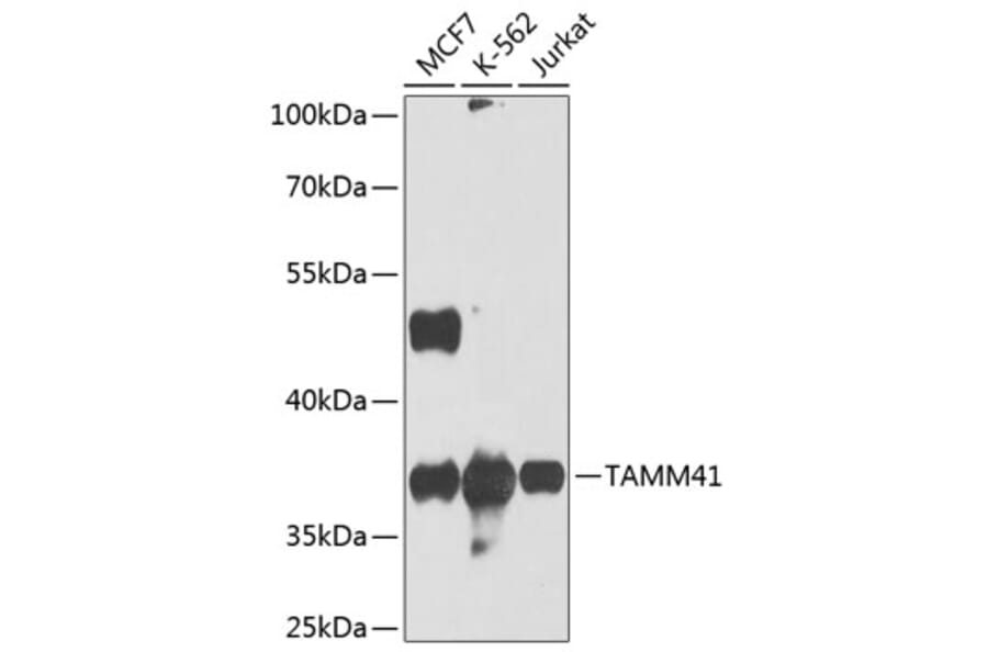 Western Blot - Anti-TAM41 Antibody (A12245) - Antibodies.com