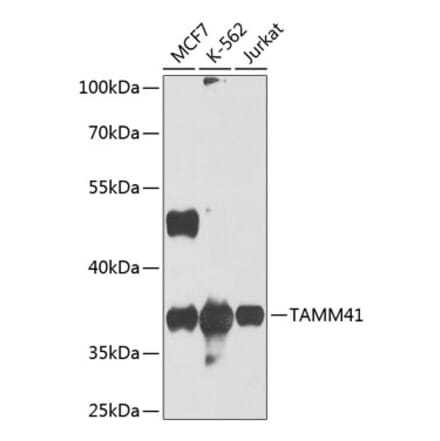 Western Blot - Anti-TAM41 Antibody (A12245) - Antibodies.com