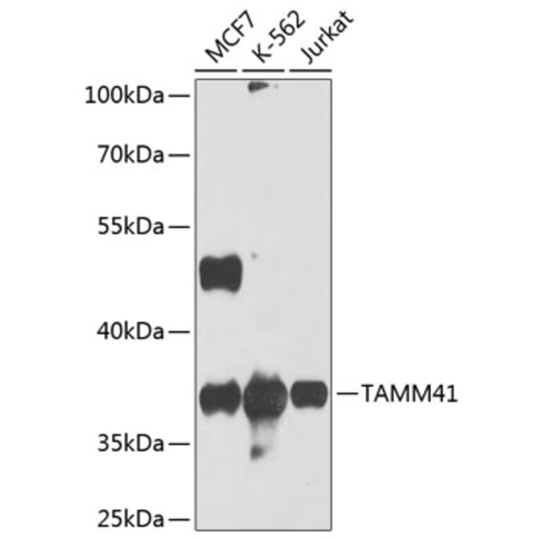 Western Blot - Anti-TAM41 Antibody (A12245) - Antibodies.com