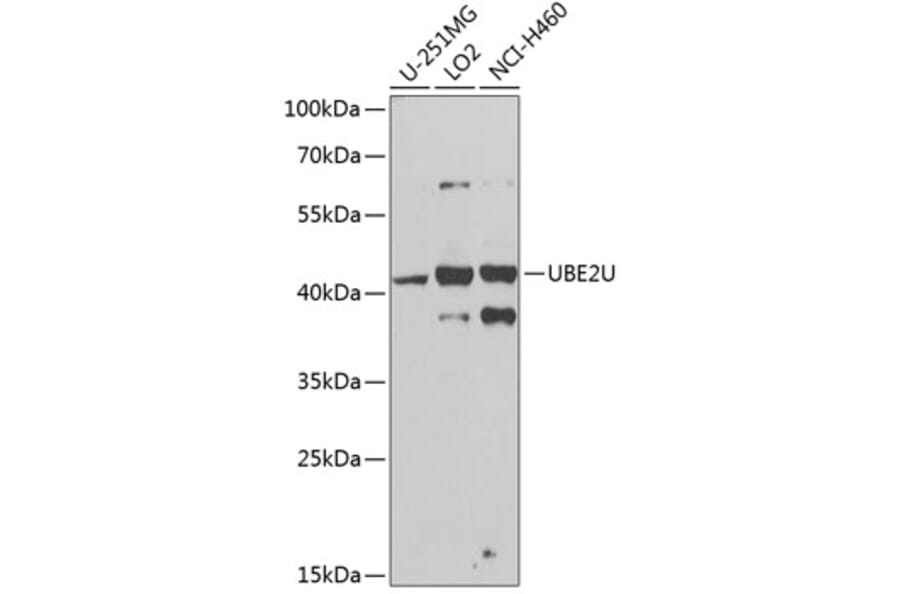 Western Blot - Anti-UBE2U Antibody (A12246) - Antibodies.com