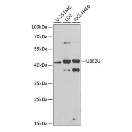 Western Blot - Anti-UBE2U Antibody (A12246) - Antibodies.com
