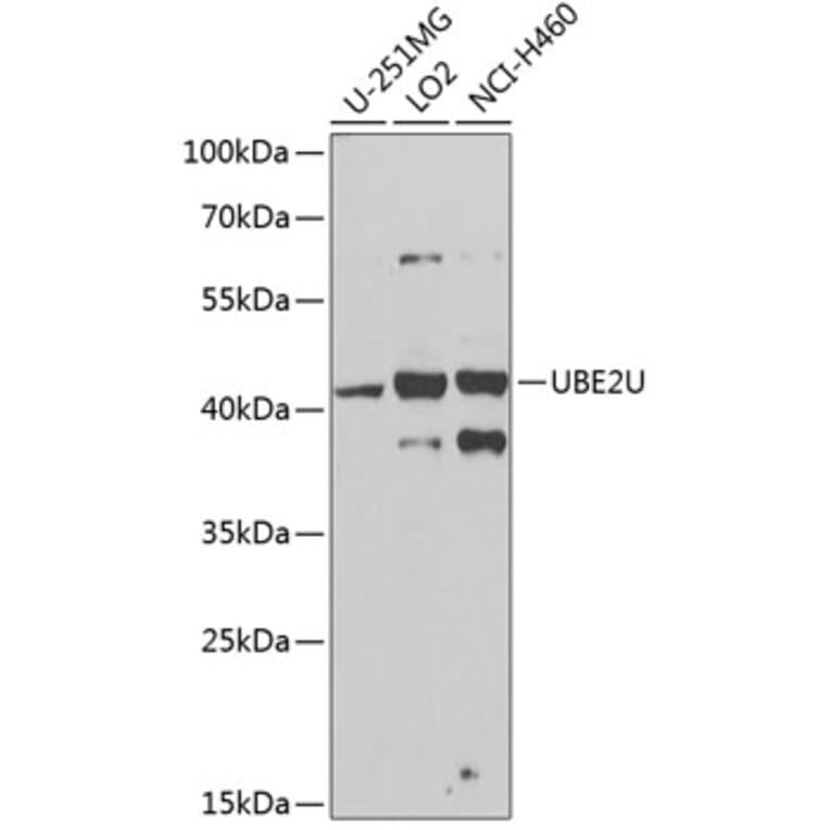 Western Blot - Anti-UBE2U Antibody (A12246) - Antibodies.com