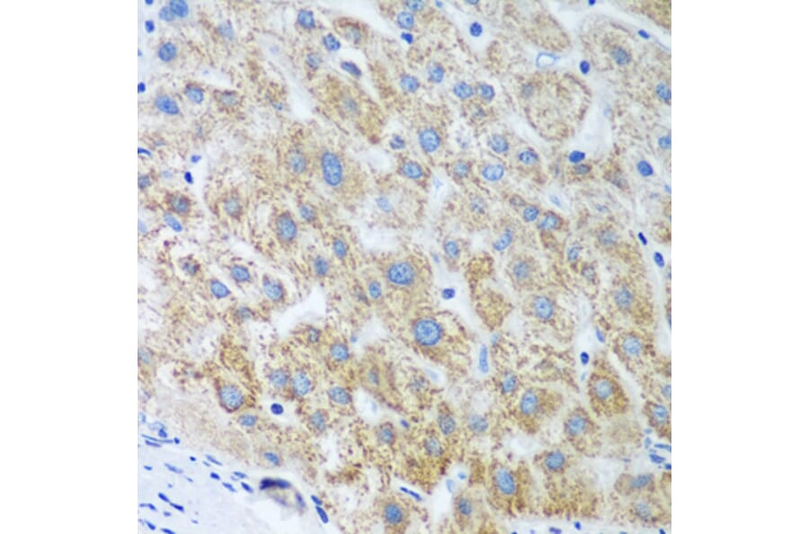 Immunohistochemistry - Anti-UBE2U Antibody (A12246) - Antibodies.com