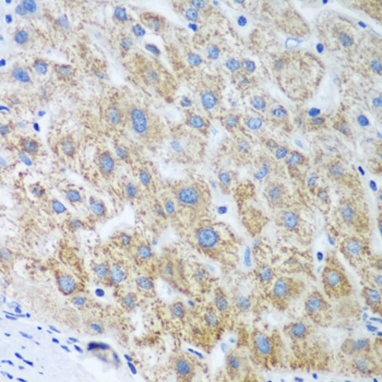 Immunohistochemistry - Anti-UBE2U Antibody (A12246) - Antibodies.com