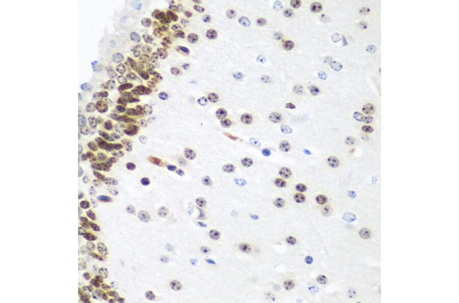Immunohistochemistry - Anti-UBE2U Antibody (A12246) - Antibodies.com