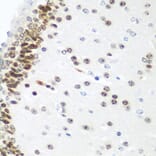 Immunohistochemistry - Anti-UBE2U Antibody (A12246) - Antibodies.com