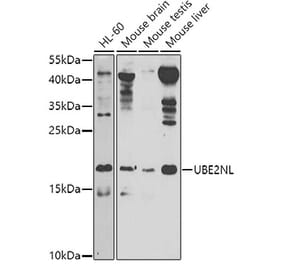 Western Blot - Anti-UBE2NL Antibody (A8381) - Antibodies.com