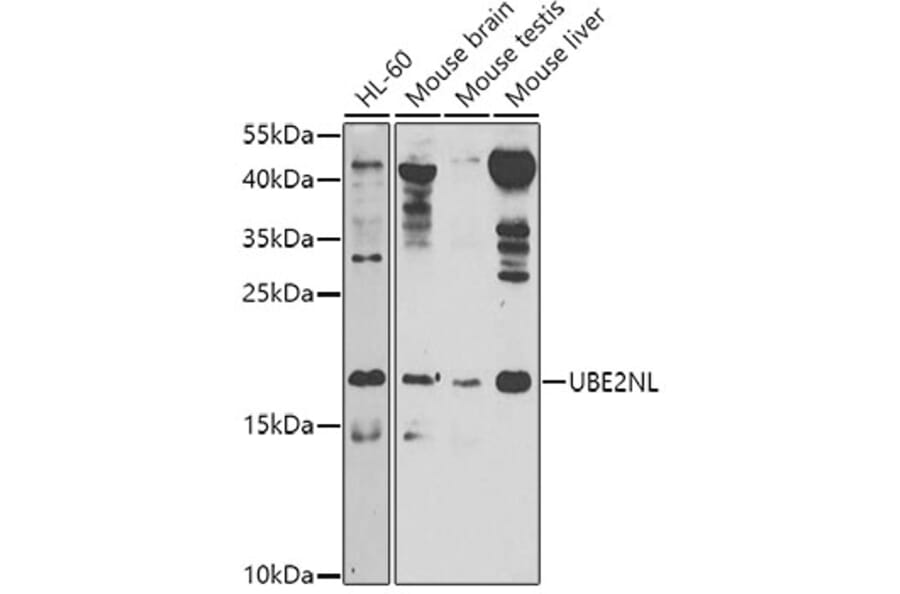 Western Blot - Anti-UBE2NL Antibody (A8381) - Antibodies.com