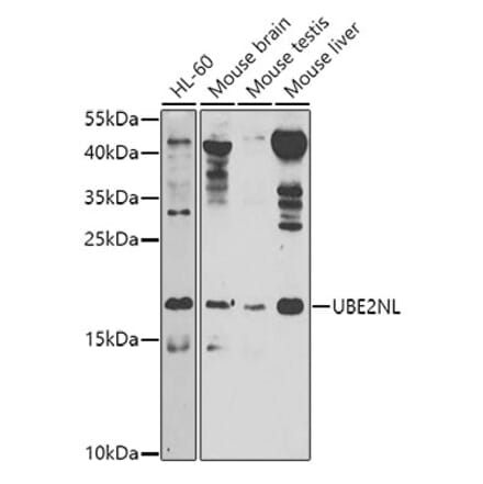 Western Blot - Anti-UBE2NL Antibody (A8381) - Antibodies.com