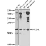 Western Blot - Anti-UBE2NL Antibody (A8381) - Antibodies.com