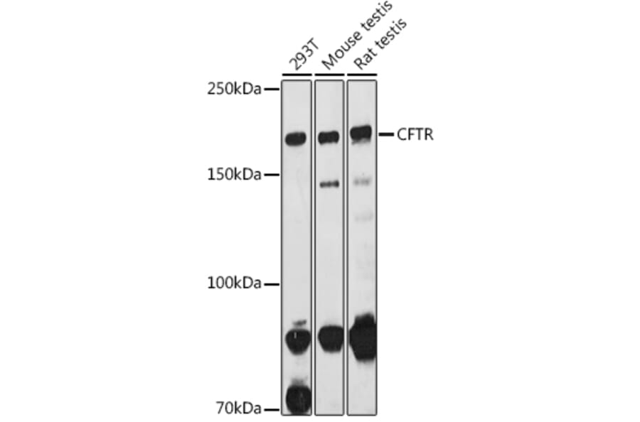 Western Blot - Anti-CFTR Antibody (A12248) - Antibodies.com