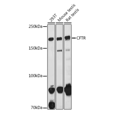 Western Blot - Anti-CFTR Antibody (A12248) - Antibodies.com