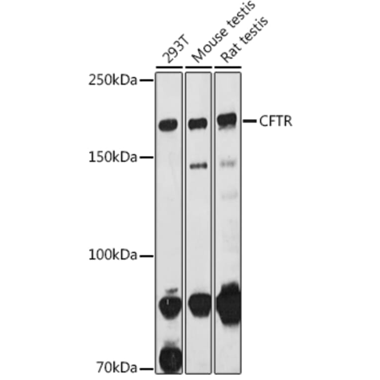 Western Blot - Anti-CFTR Antibody (A12248) - Antibodies.com