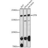 Western Blot - Anti-CFTR Antibody (A12248) - Antibodies.com