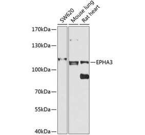 Western Blot - Anti-Eph receptor A3 Antibody (A12250) - Antibodies.com