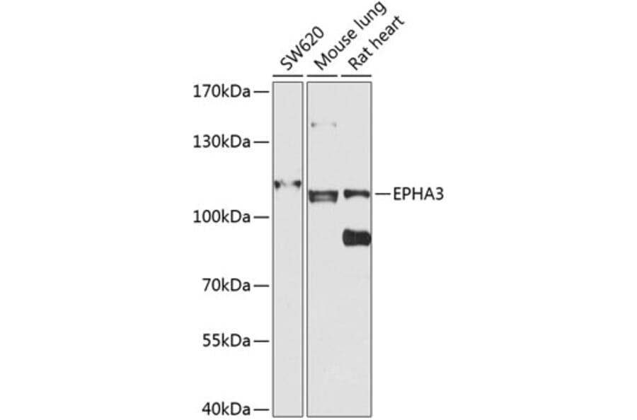 Western Blot - Anti-Eph receptor A3 Antibody (A12250) - Antibodies.com