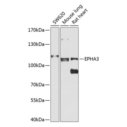 Western Blot - Anti-Eph receptor A3 Antibody (A12250) - Antibodies.com