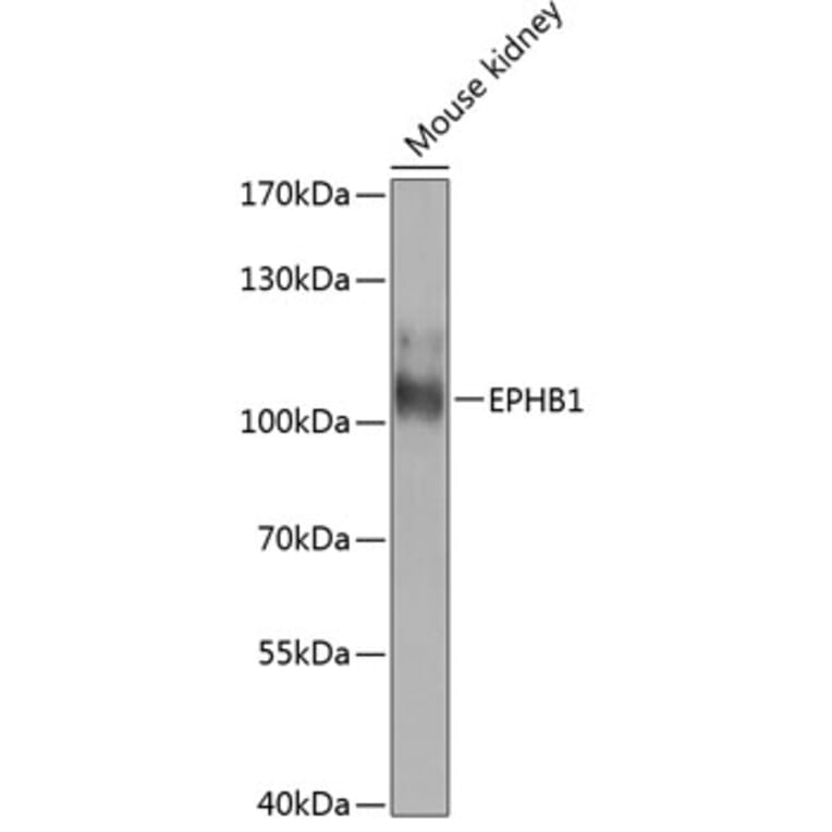 Western Blot - Anti-Eph receptor B1/NET Antibody (A12251) - Antibodies.com