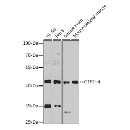 Western Blot - Anti-GTF2H4 Antibody (A12252) - Antibodies.com