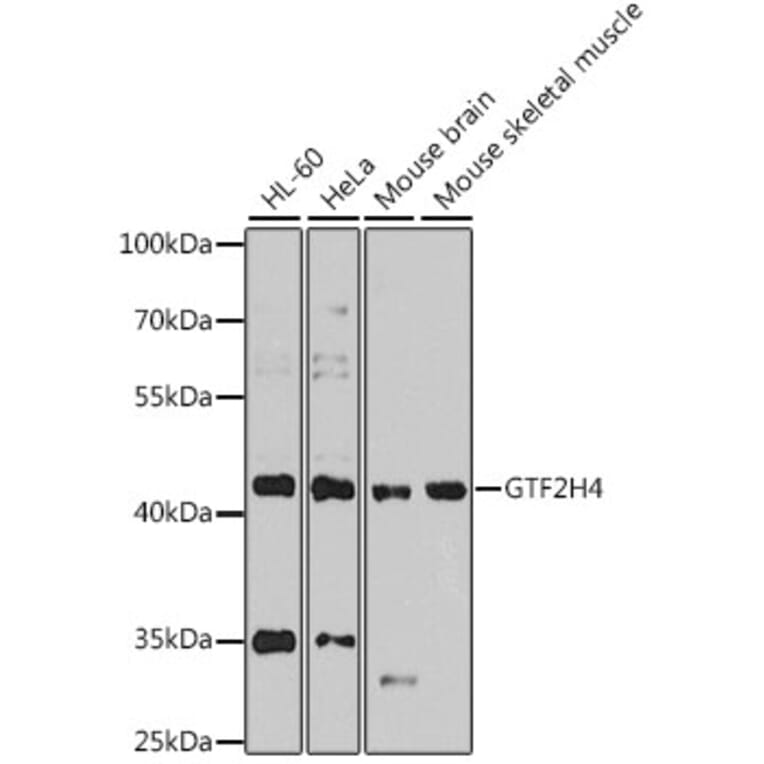 Western Blot - Anti-GTF2H4 Antibody (A12252) - Antibodies.com