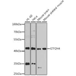 Western Blot - Anti-GTF2H4 Antibody (A12252) - Antibodies.com