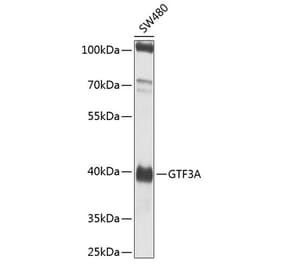 Western Blot - Anti-TFIIIA Antibody (A12253) - Antibodies.com