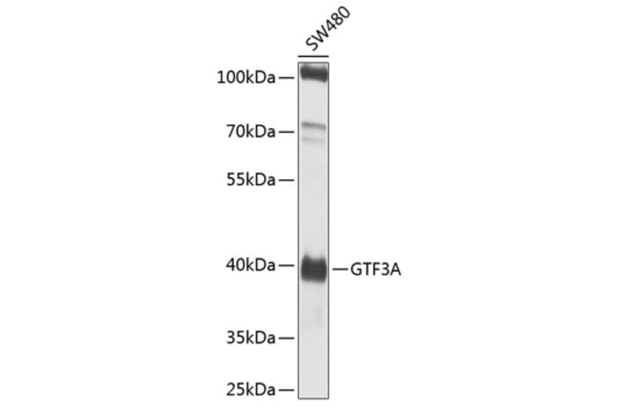 Western Blot - Anti-TFIIIA Antibody (A12253) - Antibodies.com
