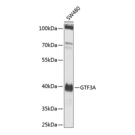 Western Blot - Anti-TFIIIA Antibody (A12253) - Antibodies.com