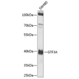 Western Blot - Anti-TFIIIA Antibody (A12253) - Antibodies.com